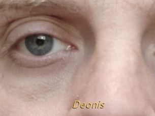 Deonis